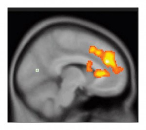pt141 anhedonia Causes, Symptoms, and Treatment Understanding Anhedonia and Why It