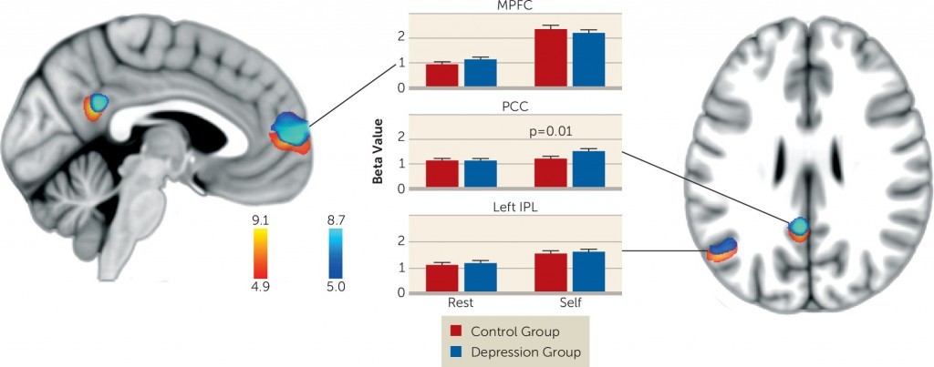 Negative Self Appraisal and Brain Activity